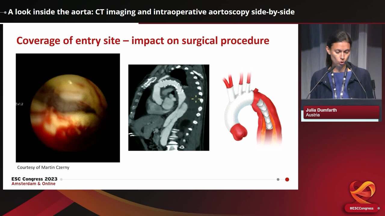 A look inside the aorta: CT imaging and intraoperative aortoscopy side-by-side