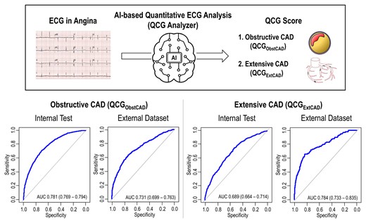 Artificial intelligence–enhanced electrocardiography analysis as a promising tool for predicting obstructive coronary artery disease in patients with stable angina